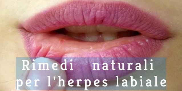 herpes labiale rimedi naturali